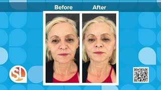 Glo Medspa can help you look years younger without surgery with facial Threading