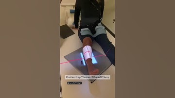 position : leg (tibia and fibula) AP x-ray #radiographer #mbbs #xray #radiology #radiologystudent