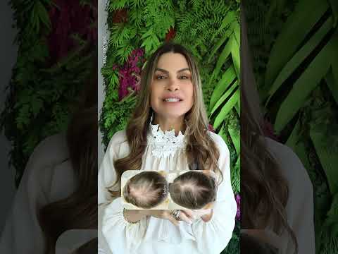 Testosterona — Agência Liz