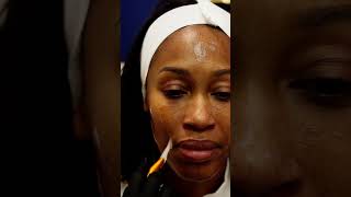 Skin Analysis at Elite Derma Med Spa Understand Your Skin Health
