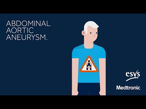 Abdominal Aortic Aneurysm - patients information
