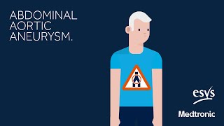 Abdominal Aortic Aneurysm - Patients Information