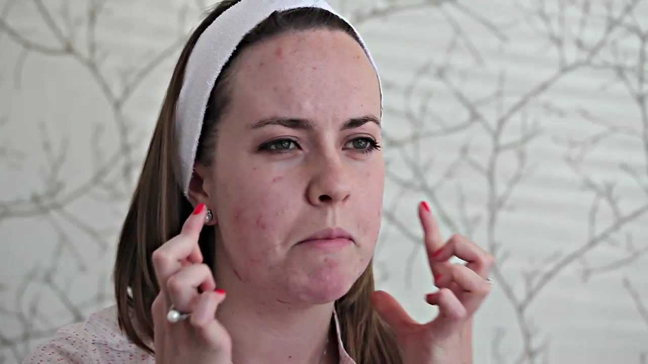 LUSTRE Pure Light Treatment for Acne - MDEA 2013 Finalist