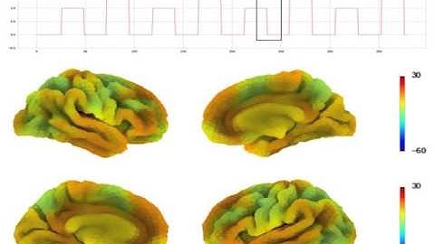 Dynamic Functional Connectivity