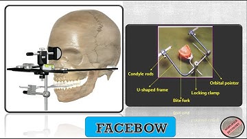 Facebow : Types and Parts of a Facebow