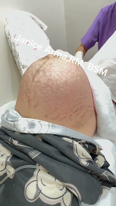 How many babies inside?