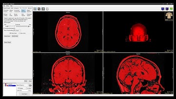 Analyze 15.0 - Segment: Fill Holes