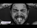 Details On Post Malone's $1MM 'VAMPIRE' Diamond Fangs!
