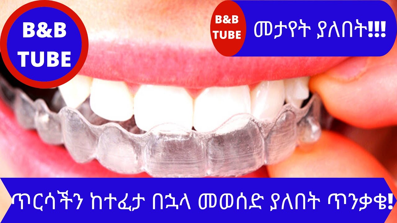 ጥርሳችን ከተፈታ በኋላ ምን ማድረግ አለብን?? (ክፍል 4)