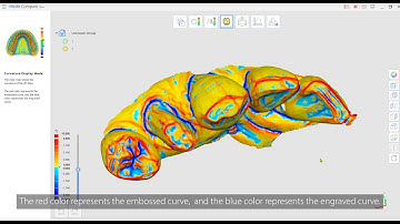 Medit Compare [Subtitles Available]