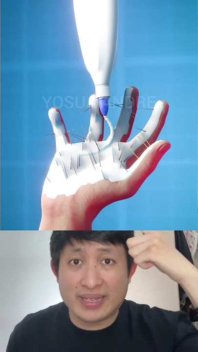 TANGAN COWOK TERTUSUK DURI KAKTUS, AKHIRNYA... | Yosua Andre #shorts #facts #tipsandtricks