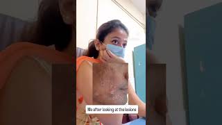 When the history says one thing but the skin says another…..#awareness #dermatology #education