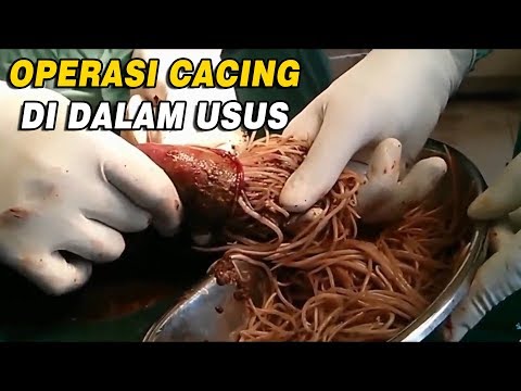 Video: Parasit Gastrointestinal (Cacing Pita) Pada Burung