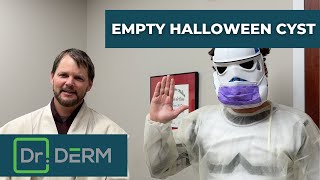 Empty Halloween Cyst | Dr. Derm