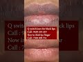 Best Q Switch Laser For Black Lips At Skinaa Clinic Viral Shorts 