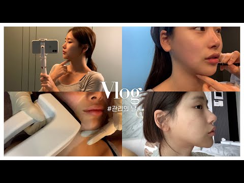 [vlog] 인간 인모드 재희의 관리의 날 브이로그 l 인모드 QnA + Before & After l 필라테스 '등록'만 하기