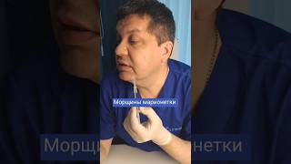 Как убрать морщины марионетки филлерами?