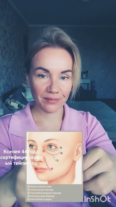 #тейпы #тейпирование #тейпированиелица от носослезной борозды, синего ...