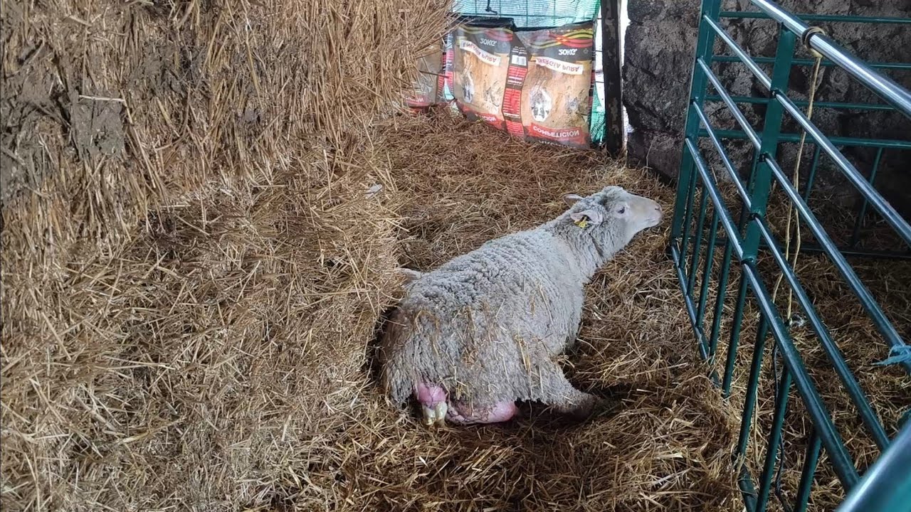 Parto múltiple, y con problemas