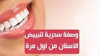 تبييض الأسنان وبتسامة المشاهير ب 2 طرق طبيعية