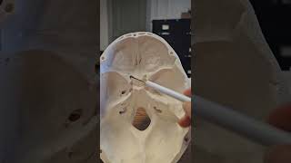 Skull - Ethmoid, Vomer, Sphenoid Bones