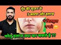 मुँह की सूजन के 3 कारण, घरेलू और क्लीनिकल इलाज । 3 Causes of mouth swelling & treatment