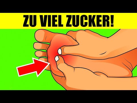 Diese Anzeichen deuten
