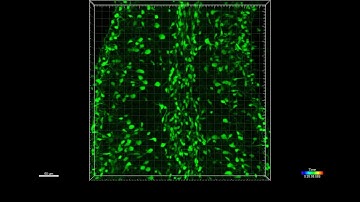 Migrating interneuron precursors in the cerebellum