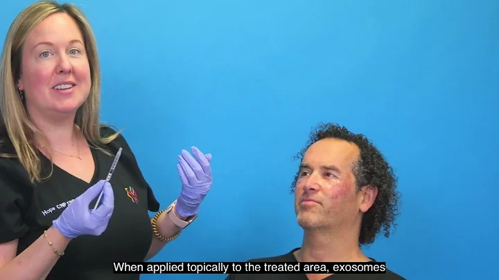 Exosomes in Laser Resurfacing: A Game-Changer for Facial Healing