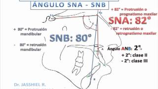 Basic Cephalometry 1 (Steiner) Basic Cephalometry 1 (Steiner)