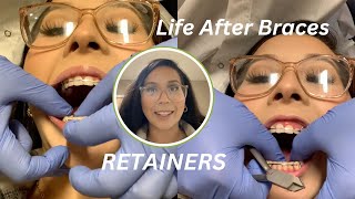 Life After Braces: Wearing RETAINERS for the first time | vlog