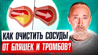 Только Так Можно Очистить Сосуды От: Холестерина, Бляшек И Тромбов! Вот И Рецепт И План Действий!