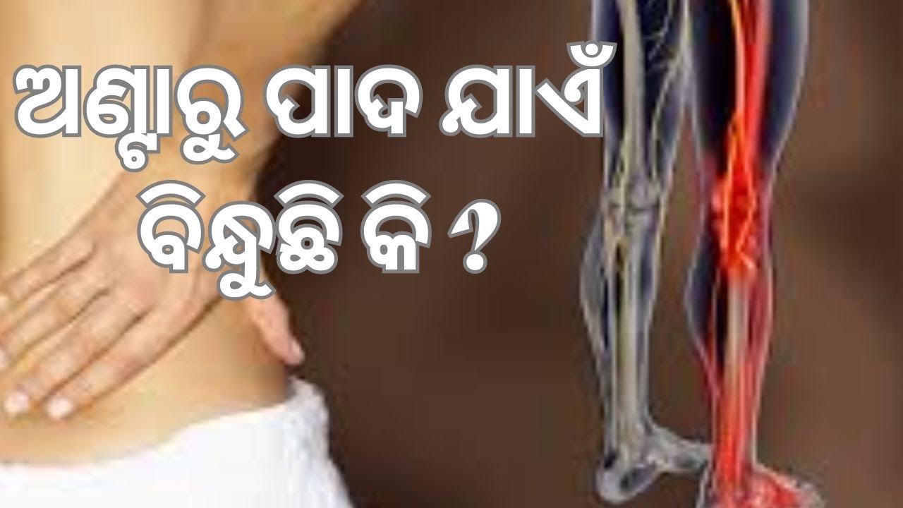ଅଣ୍ଟାରୁ ପାଦ ଯାଏଁ ବିନ୍ଧୁଛି କି | Sciatica - Symptoms and causes | stay fit