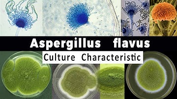 Aspergillus Flavus Culture Characteristic