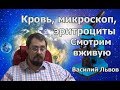 Кровь, микроскоп, эритроциты. Смотрим вживую.