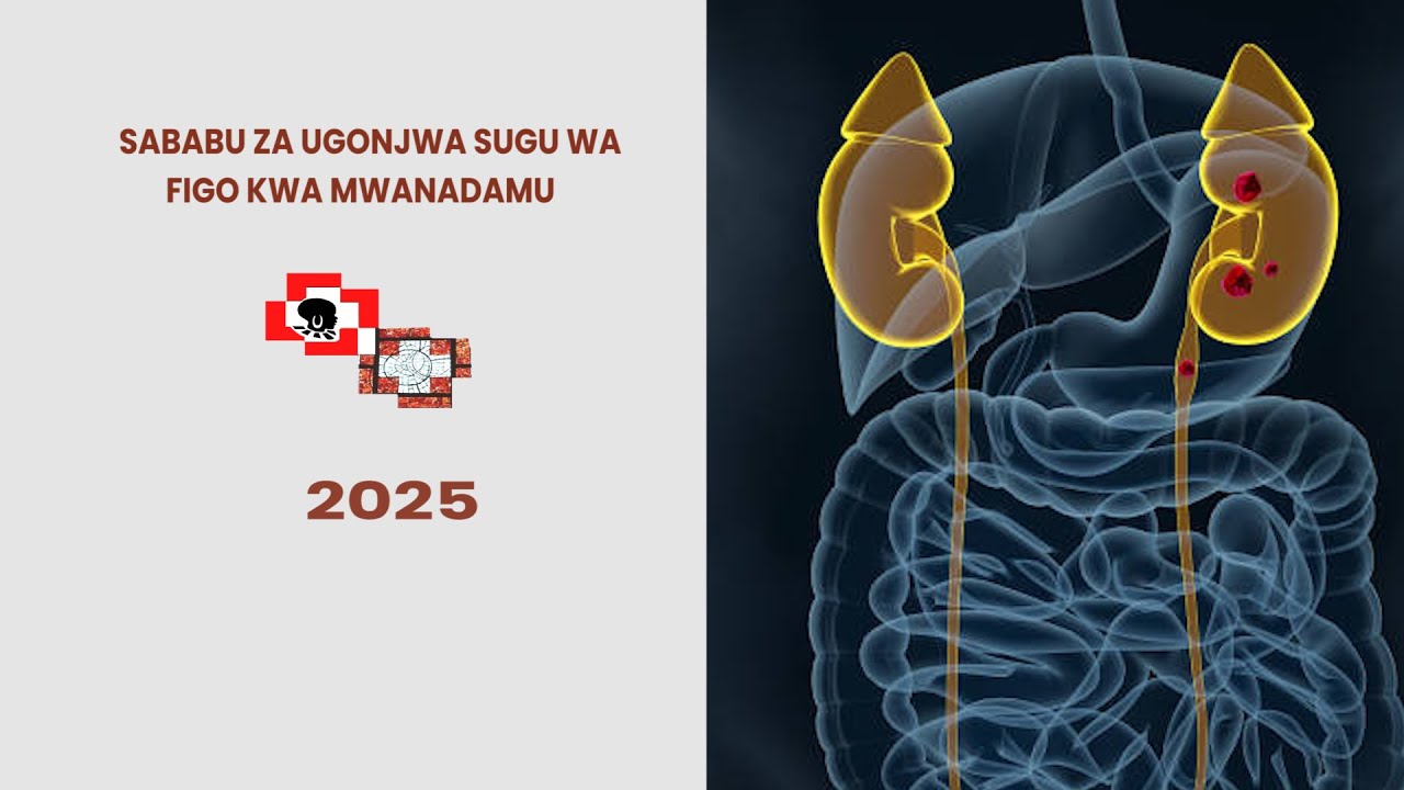 MAGONJWA YANAYO SABABISHA UGONJWA SUGU WA FIGO  | SABABU ZA UGONJWA SUGU WA FIGO