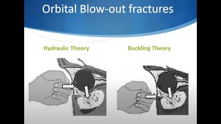 Facial Plastic Emergencies