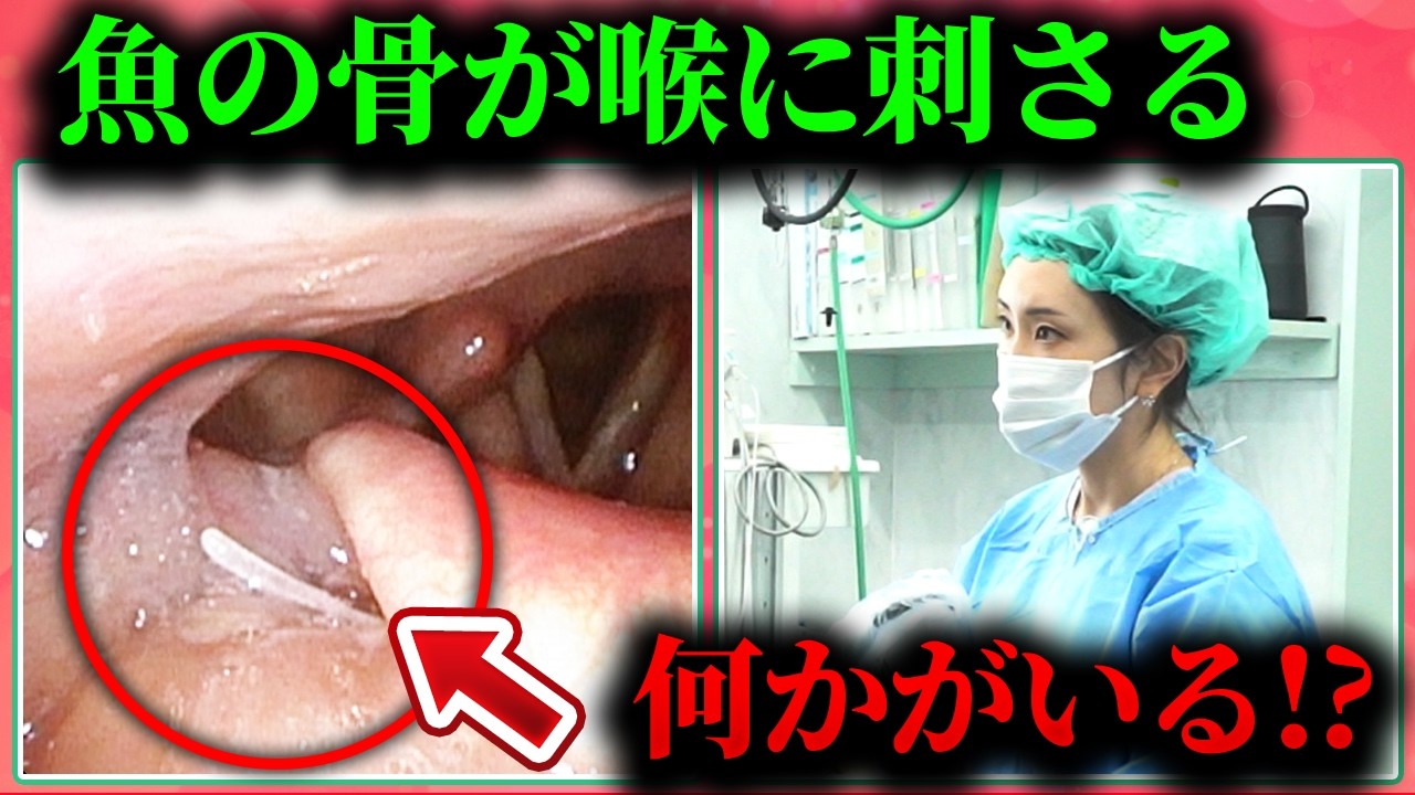 喉 に 骨 が 刺さっ た