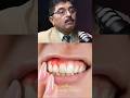 खूबसूरती में साफ दांत भी जरूरी हैं 😁 | Yellow Teeth Clean Home Remedy