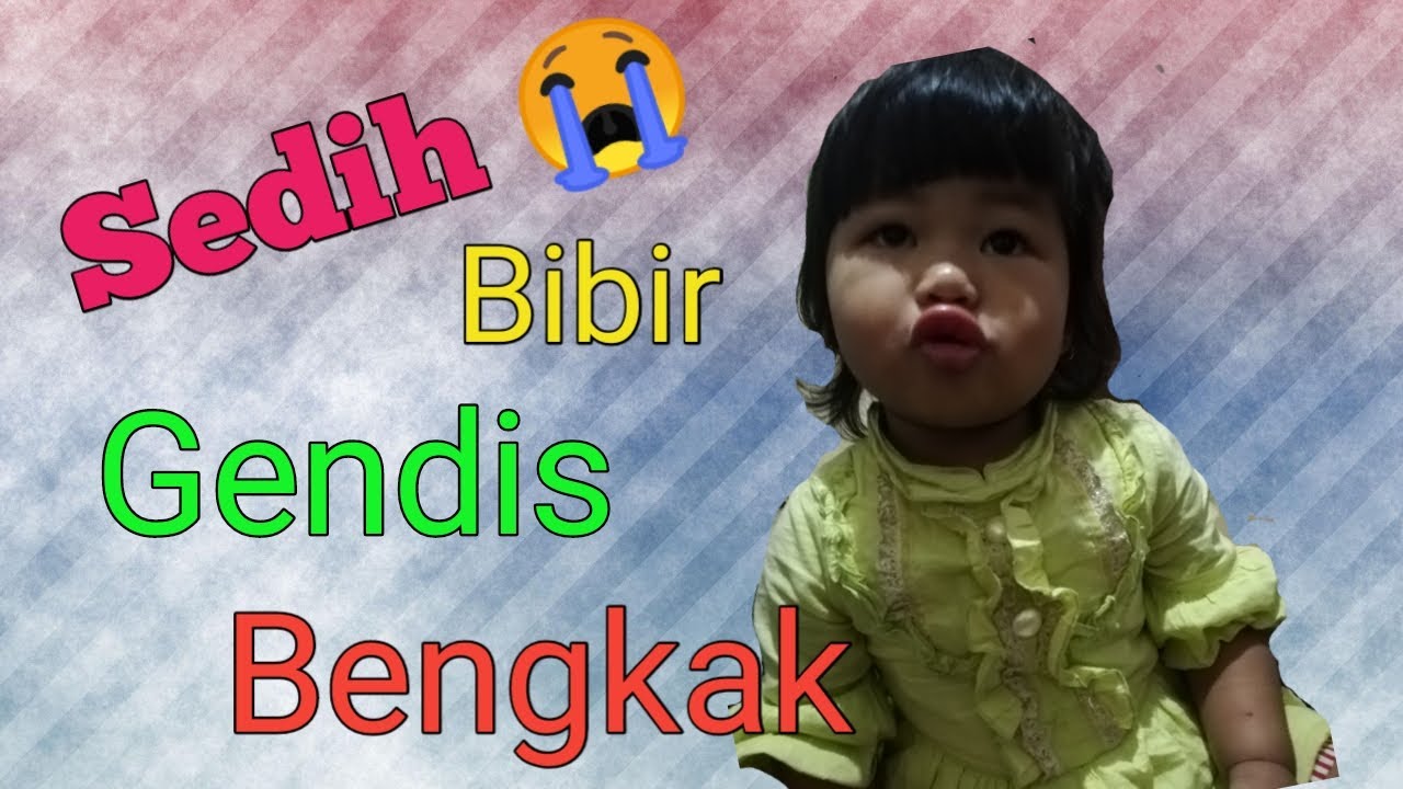 Bibir gendis bengkak 😭😭 