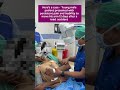 Posterior shoulder dislocations