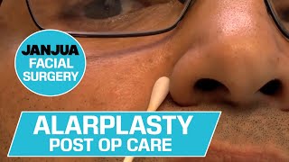 Alarplasty Post Op Care - Dr. Tanveer Janjua - New Jersey