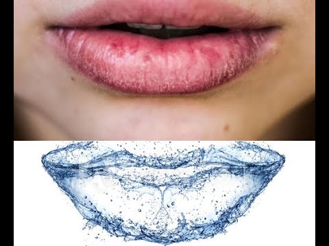 Video: Buzët E Blogerit U Kthyen Në Blu Për Shkak Të Një Operacioni Kozmetik Të Pasuksesshëm