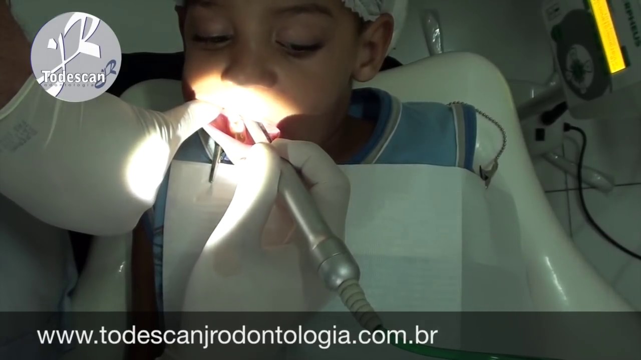 Anestesia sem dor — criança de 4 anos