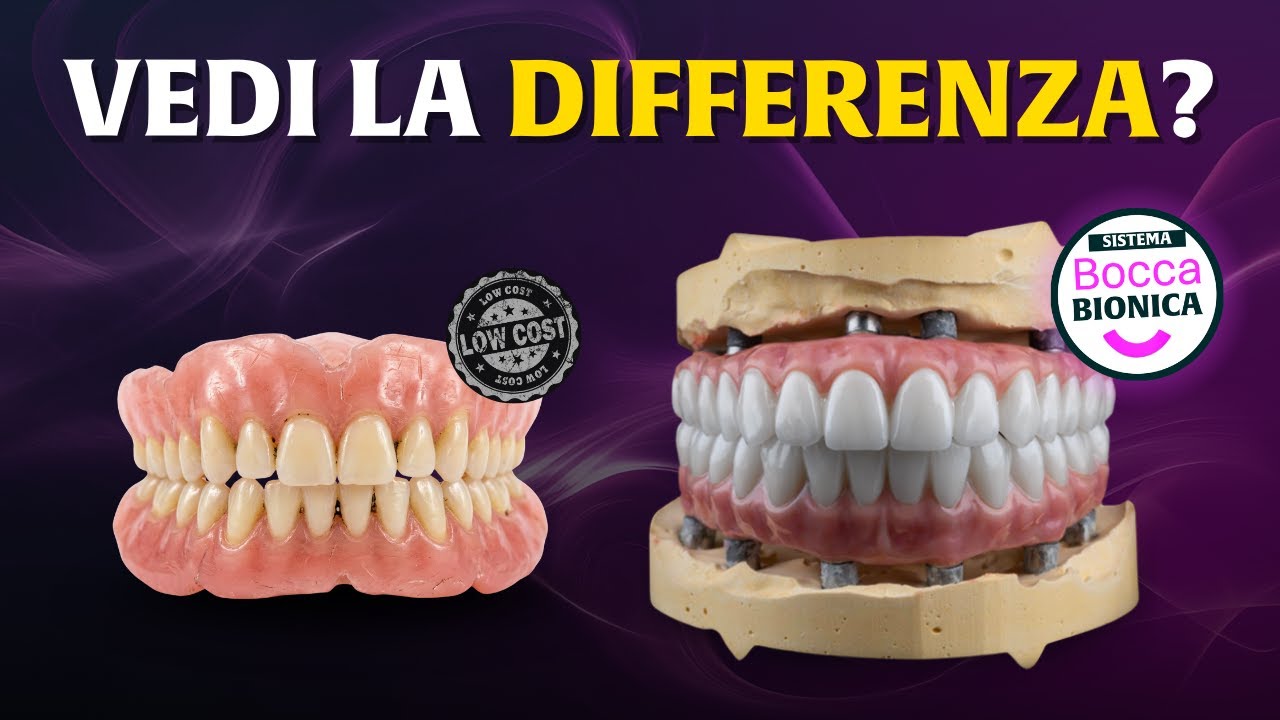 Denti fissi che sembrano finti? Ecco gli errori da evitare