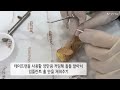 임플란트 토크/ 홀 매꾸기