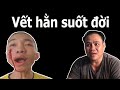 Ba Diễm My Nói Về Lý Do Gây Thương Tích Thầy Nhị Nguyên Ở Tịnh Thất Bồng Lai