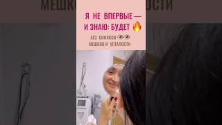 Убрать синяки под глазами быстро. Отзыв пациентки на биоревитализацию