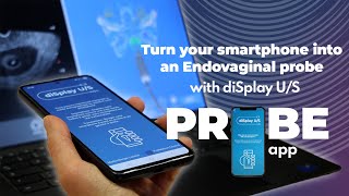 Turn your smartphone into an Endovaginal probe screenshot 5