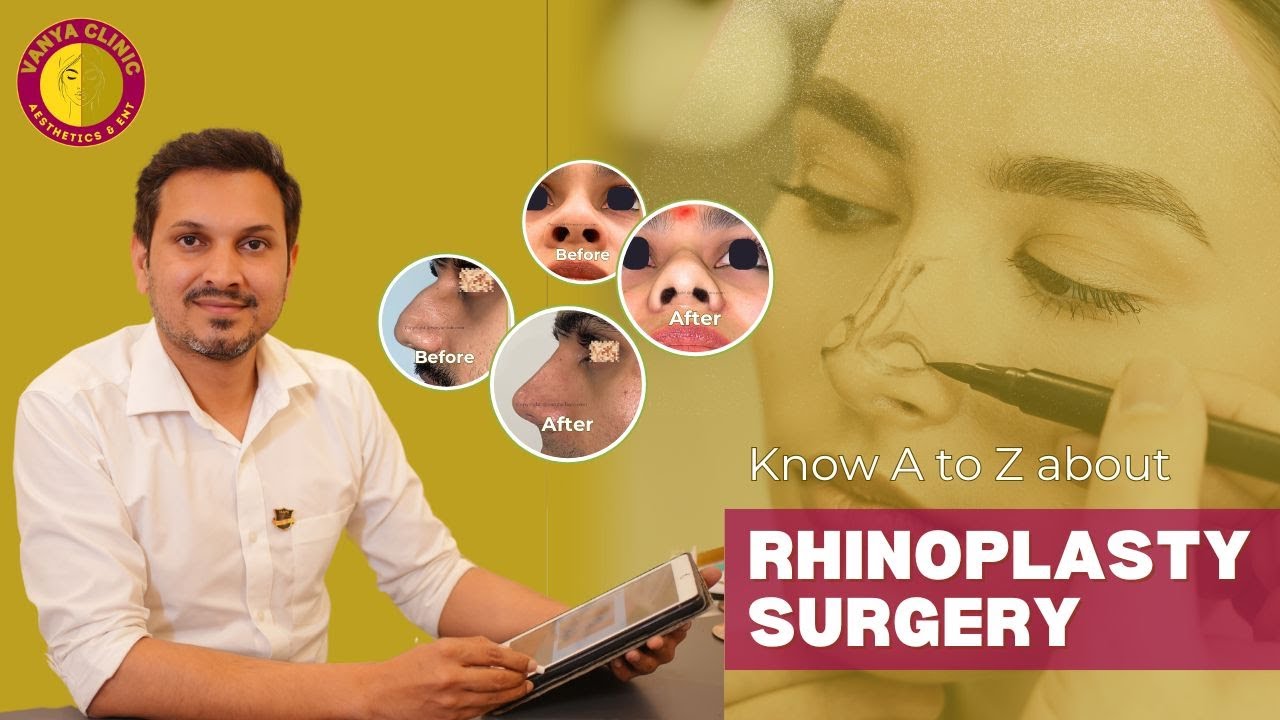 Rhinoplasty A to Z | Nose Reshaping, Breathing Issues & Recovery | Dr Anil Kumar Kaler